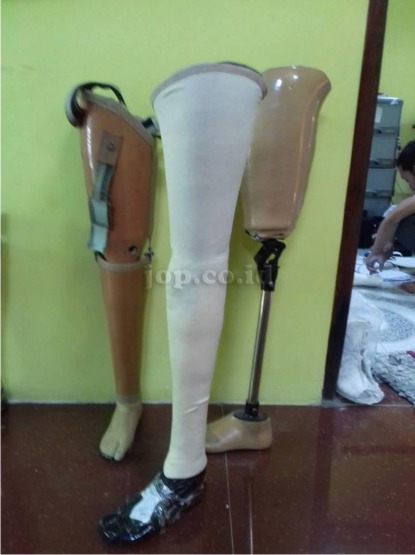 bahan pembuat kaki palsu