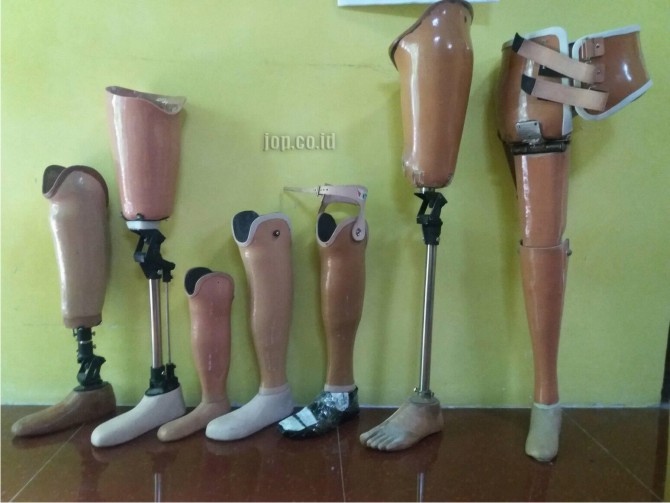 harga kaki palsu